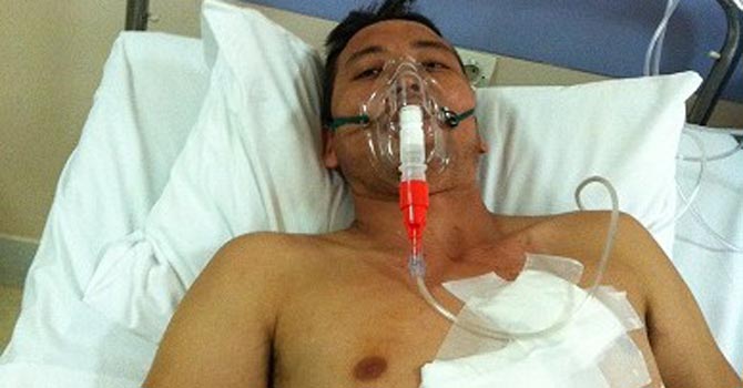greece-asylum-seekers-violence-afp3-670 Handout file picture from the Human Rights Watch shows Ali Rahimi, a 27-year-old Afghan asylum seeker, in the hospital just after he and two of his friends were attacked in September 2011 by a large group of people outside an apartment building in the Aghios Panteleimonas neighborhood in Athens. – Photo by AFP