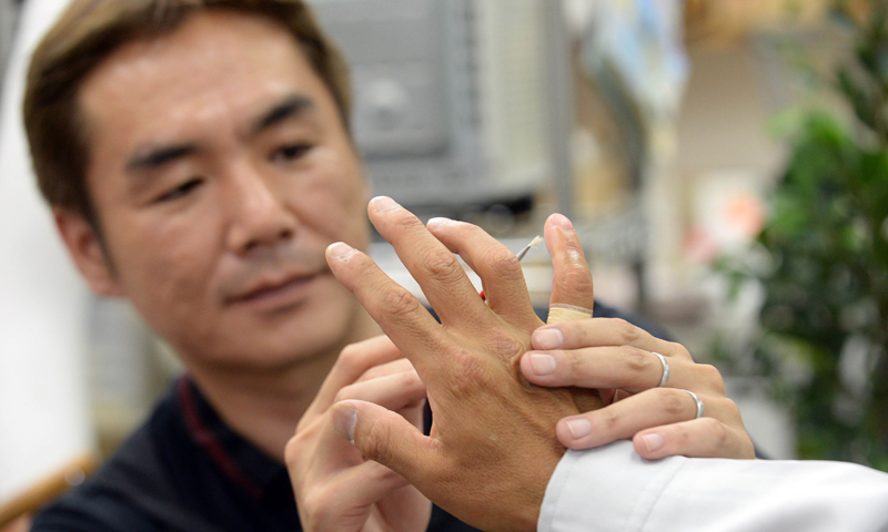 Fake Fingers Help Ex Japanese Mobster Lead Lawful Life World DAWN COM