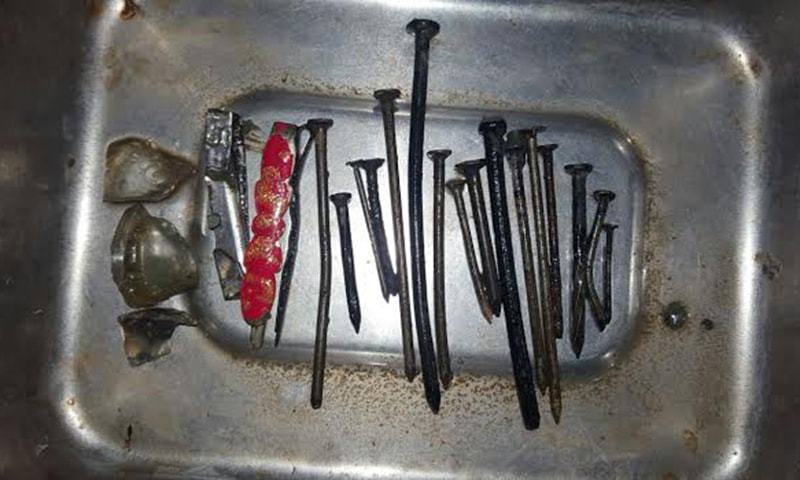 Objects removed from the patient&#39;s stomach include long metal nails, hair clips and pieces of glass. — Photo by author