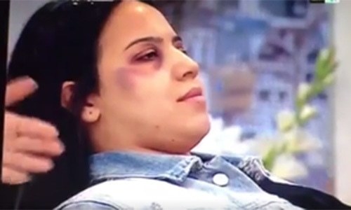 Morocco TV &lsquo;sorry&rsquo; over make-up for battered women