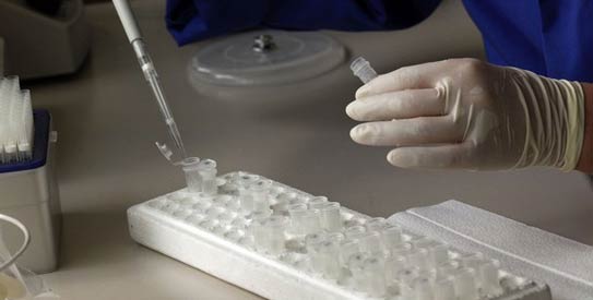Blood Clotting