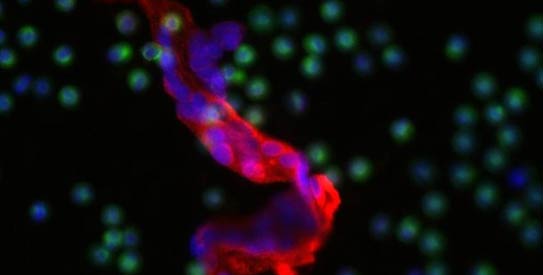 cancer-cell-R543