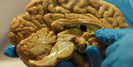 human-brain-r543