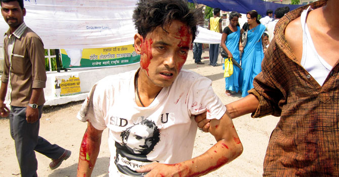 A man injured in a blast in Southern Nepal is led away from the site of the attack.