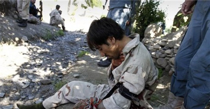 A-wounded-member-of-the-Afghan-police670 A wounded member of the Afghan police.—AP Photo