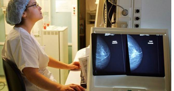 Doctor examining a breast image. - Photo by AFP
