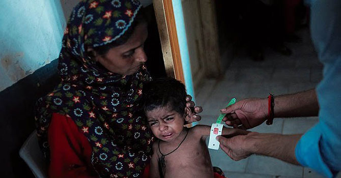 A child getting vaccination for measles in a Sindh hospital. ( File photo by AP)