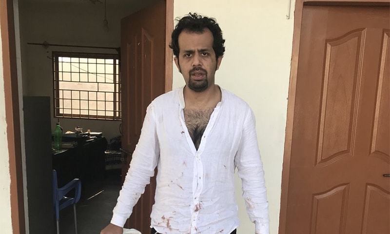 Journalist Taha Siddiqui at a police station after being beaten by armed men.─Photo courtesy: Twitter