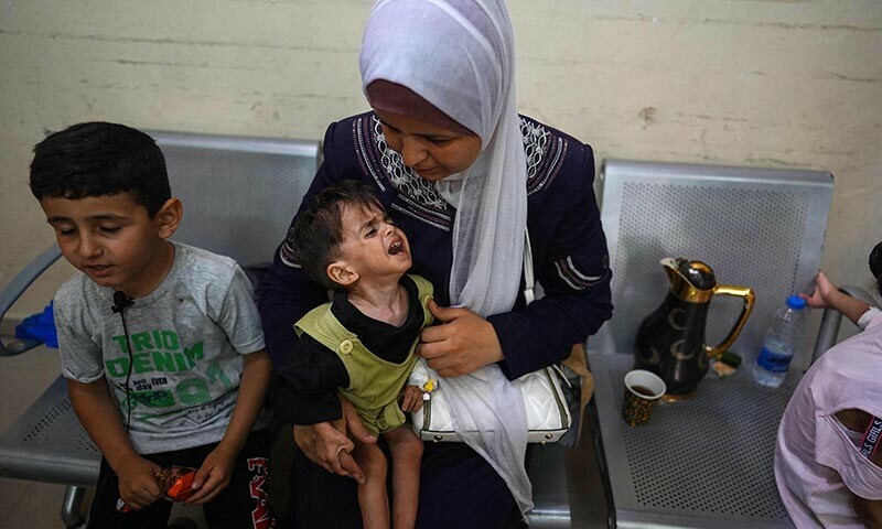 Palestinian children suffering of malnutrition or chronic diseases such as cancer, wait with family members at Nasser hospital in Khan Yunis in the southern Gaza Strip on June 24. &mdash; AFP