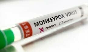 Second mpox case of 2025 detected at Peshawar airport
