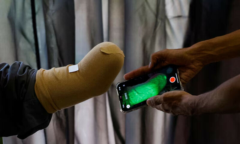 A technician uses a mobile phone for 3D scan of a patient before developing a prosthetic limb at Bioniks, in Karachi, April 29, 2024. — Reuters