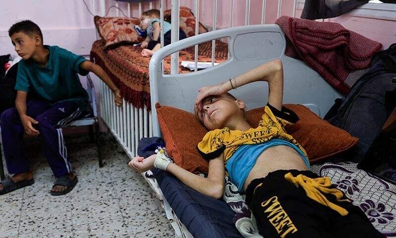 Palestinian girl Huda Abu Al-Naja lies on a bed as she receives treatment at the malnutrition ward at Nasser hospital in Khan Younis, southern Gaza Strip, August 5, 2025. &mdash; Reuters