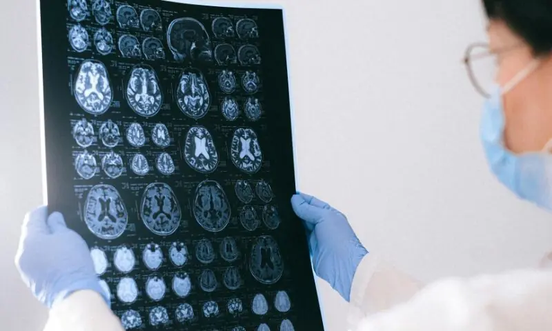   اگر آپ غیر معمولی سر درد کا شکار رہتے ہیں تو اپنے معالج سے رابطہ کریں  