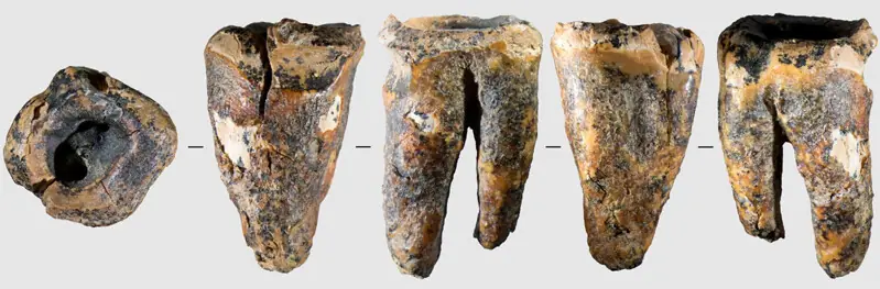 A VIEW from five different angles of a molar of an adult individual.—Reuters