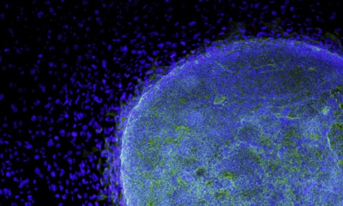 Scientists create human stem cells through cloning