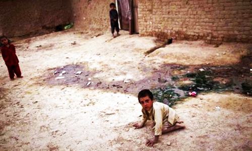 Most Pakistani children living unhealthily: report