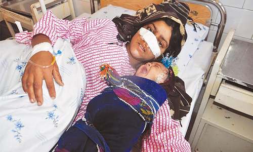 Afghan cuts off wife&rsquo;s nose, outrages nation