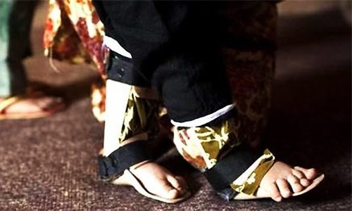 Karachi polio virus infects Quetta boy