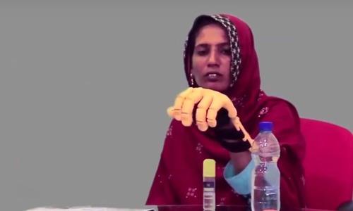 How 3D prosthetics change lives in Pakistan How 3D prosthetics change lives in Pakistan