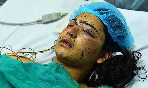 Diary of a Kashmir curfew: 'Our eyes are crucial to envisioning our future'