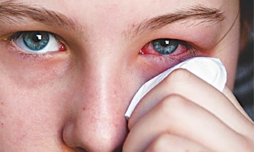 &lsquo;Cousin marriages main cause of eye diseases&rsquo;