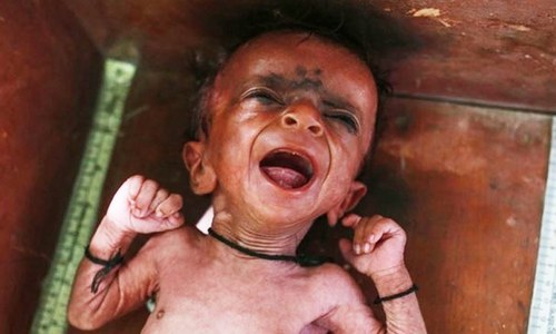 Dispatch from Balochistan: How mothers try to keep their newborns alive