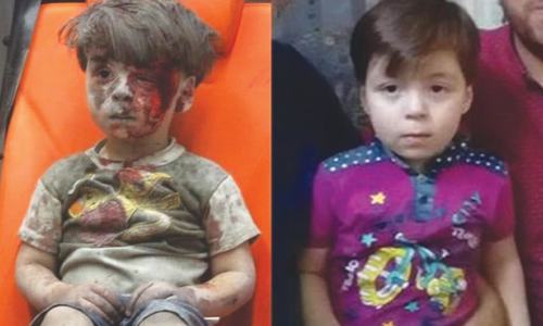 Omran, ‘real face’ of Syrian conflict, appears in Russian event Omran, ‘real face’ of Syrian conflict, appears in Russian event