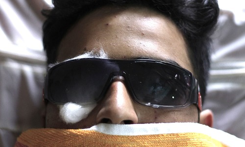 Amnesty International urges ban on pellet shotguns in held Kashmir
