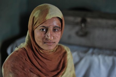 Long road to justice for acid attack survivors in India