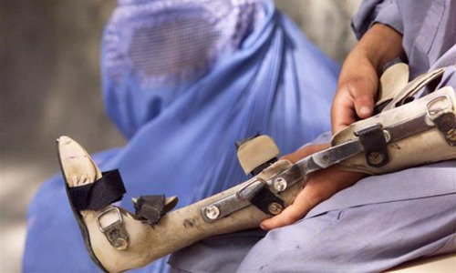 First polio case of 2018 reported in Balochistan