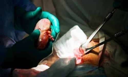 Organ trade gang busted by FIA; four arrested