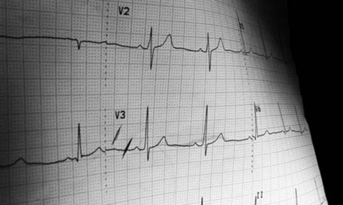 Head of Nawaz’s medical team suffers cardiac arrest Head of Nawaz’s medical team suffers cardiac arrest
