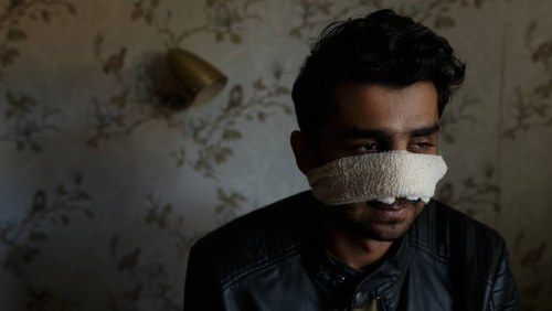 Pakistani student&rsquo;s nose broken in attack in Australia
