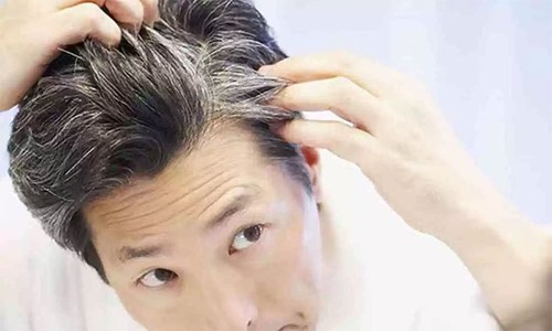 بالوں کی قبل از وقت سفیدی دور کرنے والے ٹوٹکے