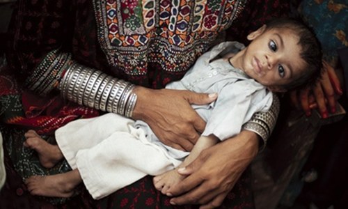 I'm glad Imran Khan has highlighted stunting. But there is more to it than clean water and food I'm glad Imran Khan has highlighted stunting. But there is more to it than clean water and food