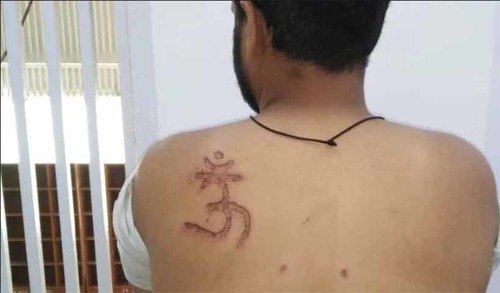 Muslim prisoner in India's Tihar jail branded with 'Om' symbol