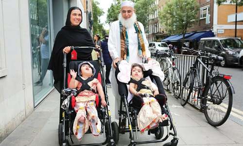 Pakistani conjoined twins separated in UK