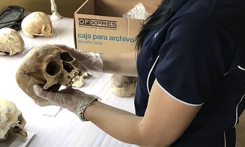 Skin-crawling discovery: 'body farm' scientists find corpses move