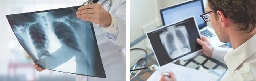 HEALTH: TUBERCULOSIS IS ASIA’S SILENT KILLER HEALTH: TUBERCULOSIS IS ASIA’S SILENT KILLER