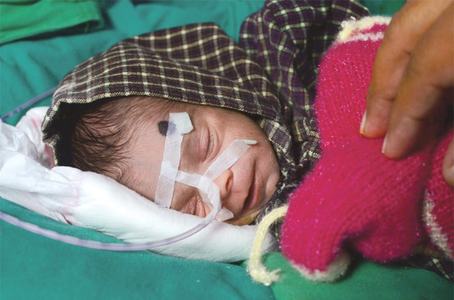 India’s ‘miracle baby’ making recovery in hospital India’s ‘miracle baby’ making recovery in hospital