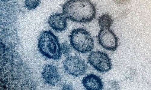 This undated electron microscope image made available by the U.S. National Institutes of Health in February 2020 shows the Novel Coronavirus SARS-CoV-2. Also known as 2019-nCoV, the virus causes COVID-19. The sample was isolated from a patient in the U.S. Dozens of research groups around the world are racing to create a vaccine as COVID-19 cases continue to grow. &mdash; NIAID-RML via AP