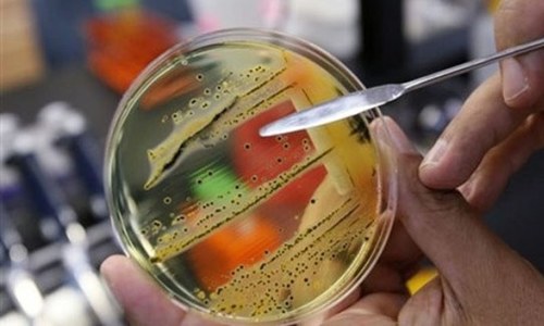 Antimicrobial resistance one of the biggest public health threats in the world: NIH head