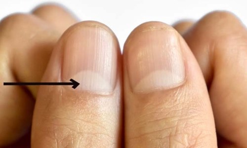 ناخن پر 'نصف چاند' کیوں ہوتے ہیں؟