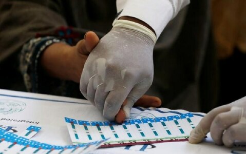 Experts concerned over alarming rise of HIV/AIDS cases countrywide