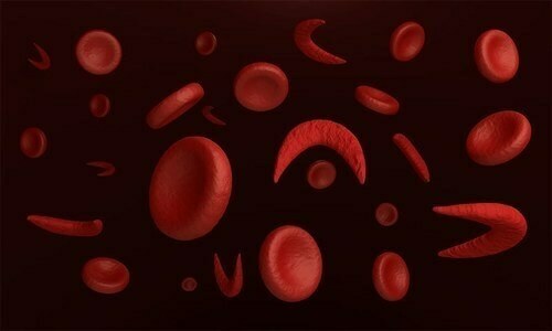 انسانی خون میں پہلی بار پلاسٹک کے ننھے ذرات دریافت