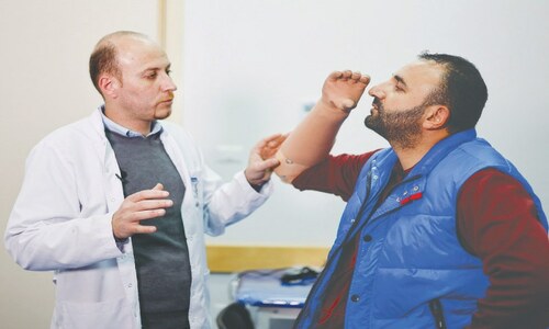 Bionic limbs lift Gaza amputees’ self-esteem