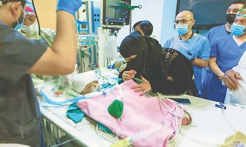 Saudi doctors separate conjoined twins from Yemen