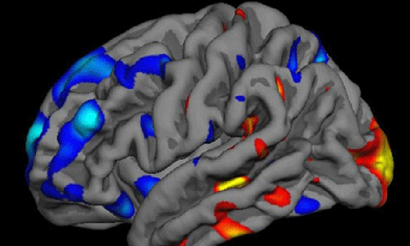 Scientists use brain scans and AI to ‘decode’ thoughts Scientists use brain scans and AI to ‘decode’ thoughts