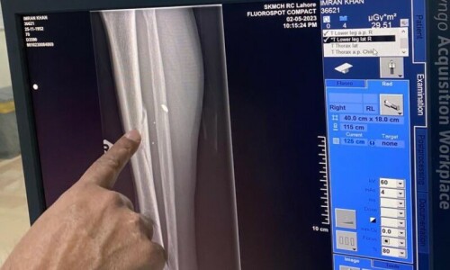 Imran’s leg again fractured by shove in court: PTI Imran’s leg again fractured by shove in court: PTI