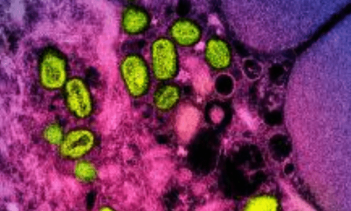 WHO declares mpox no longer a health emergency